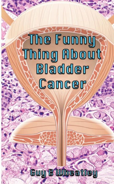 The Funny Thing About Bladder Cancer