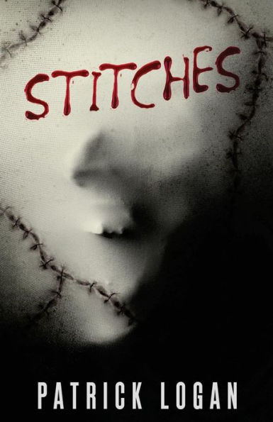 Stitches