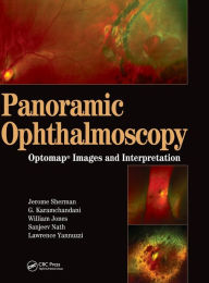 Title: Panoramic Ophthalmoscopy: Optomap Images and Interpretation / Edition 1, Author: Jerry Sherman