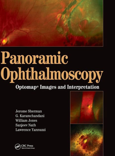 Panoramic Ophthalmoscopy: Optomap Images and Interpretation / Edition 1