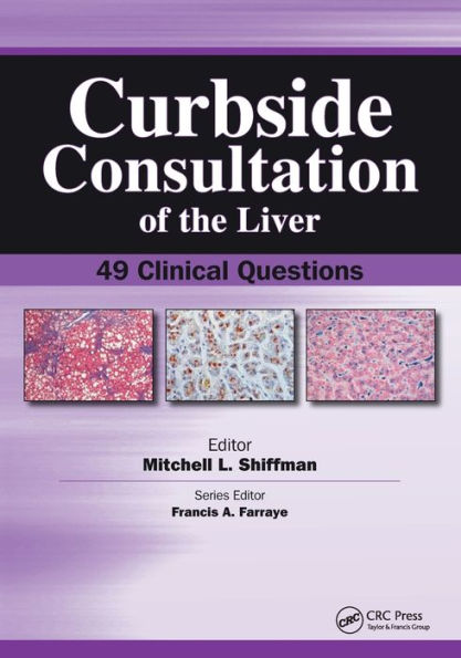 Curbside Consultation of the Liver: 49 Clinical Questions / Edition 1