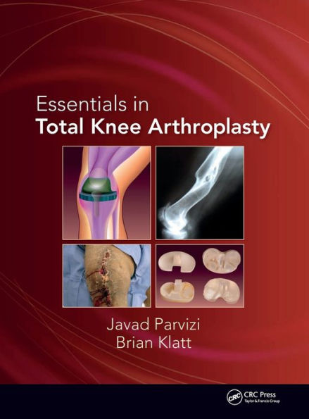 Essentials in Total Knee Arthroplasty / Edition 1