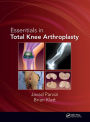 Essentials in Total Knee Arthroplasty / Edition 1