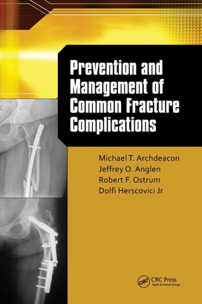 Prevention and Management of Common Fracture Complications / Edition 1