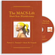 Title: MACs-Lift Short Scar Rhytidectomy, Author: Patrick L. Tonnard