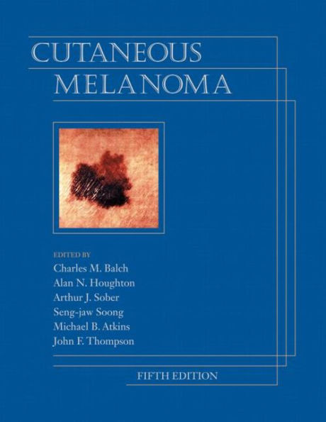 Cutaneous Melanoma, Fifth Edition / Edition 5