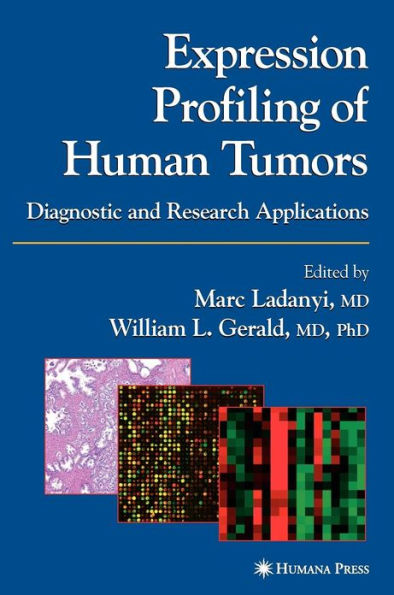 Expression Profiling of Human Tumors: Diagnostic and Research Applications / Edition 1