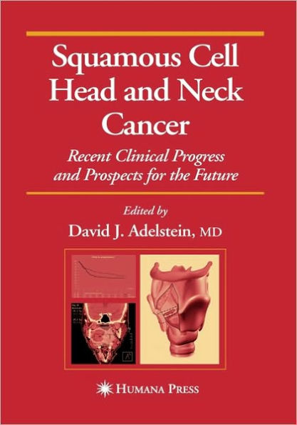 Squamous Cell Head and Neck Cancer: Recent Clinical Progress and Prospects for the Future / Edition 1