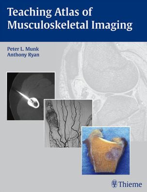 Teaching Atlas of Musculoskeletal Imaging