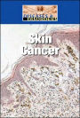 Skin Cancer