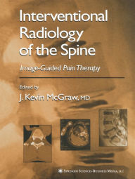 Title: Interventional Radiology of the Spine: Image-Guided Pain Therapy, Author: J. Kevin McGraw