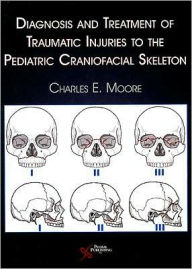 Title: Diagnosis and Treatment of Traumatic Injuries to the Pediatric Craniofacial Skeleton, Author: Charles E. Moore