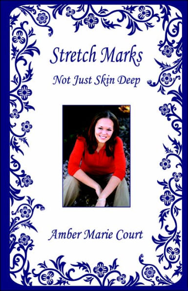 Stretch Marks: Not Just Skin Deep