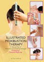 Illustrated Moxibustion Therapy: A Natural Way of Prevention and Treatment through Traditional Chinese Medicine