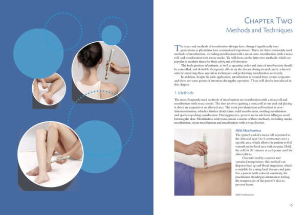 Illustrated Moxibustion Therapy: A Natural Way of Prevention and Treatment through Traditional Chinese Medicine