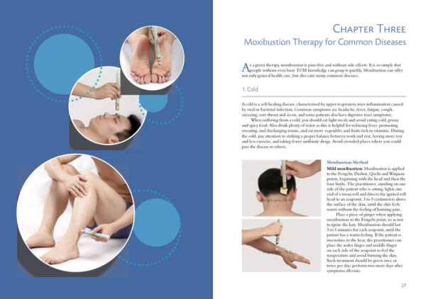 Illustrated Moxibustion Therapy: A Natural Way of Prevention and Treatment through Traditional Chinese Medicine