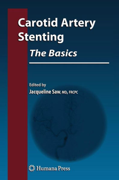 Carotid Artery Stenting: The Basics / Edition 1