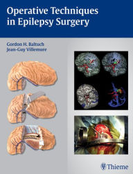 Title: Operative Techniques in Epilepsy Surgery, Author: Thieme Publishers New York