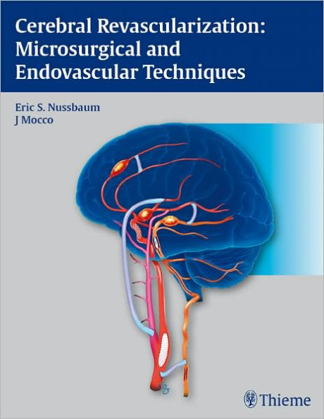 Cerebral Revascularization: Microsurgical and Endovascular Techniques: Microsurgical and Endovascular Techniques