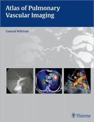 Title: Atlas of Pulmonary Vascular Imaging, Author: Conrad Wittram