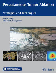 Title: Percutaneous Tumor Ablation: Strategies and Techniques, Author: Kelvin Hong