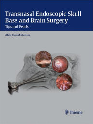 Title: Transnasal Endoscopic Skull Base and Brain Surgery: Tips and Pearls, Author: Aldo C. Stamm