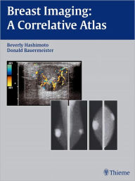 Title: Breast Imaging: A Correlative Atlas, Author: Beverly Hashimoto