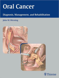 Title: Oral Cancer: Diagnosis, Management, and Rehabilitation, Author: John W. Werning