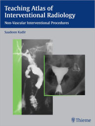 Title: Teaching Atlas of Interventional Radiology: Non-Vascular Interventional Procedures, Author: Saadoon Kadir