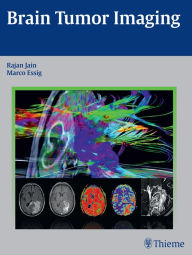 Title: Brain Tumor Imaging, Author: Rajan Jain