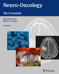 Title: Neuro-Oncology: The Essentials, Author: Mark Bernstein