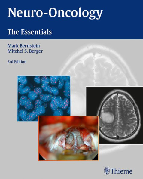 Neuro-Oncology: The Essentials / Edition 3