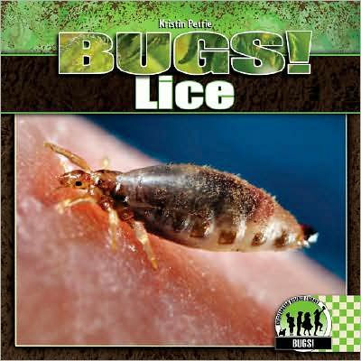 Lice