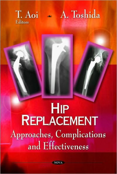 Hip Replacement: Approaches, Complications and Effectiveness