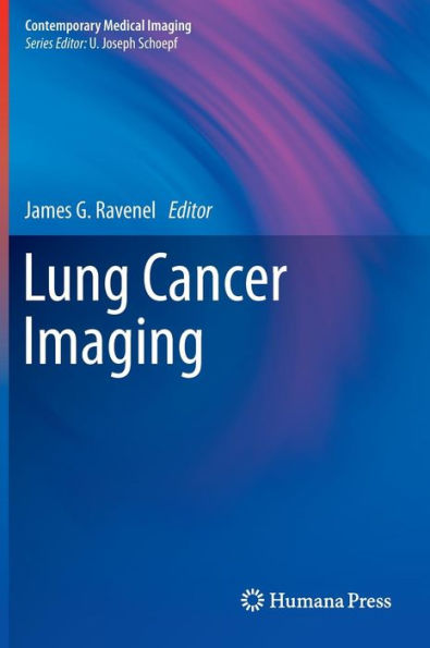 Lung Cancer Imaging / Edition 1