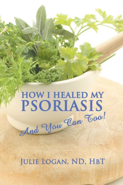 How I Healed My Psoriasis: And You Can Too!