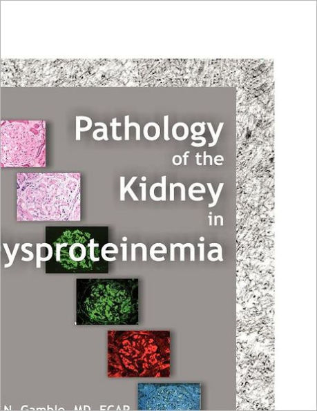 Pathology of the Kidney in Dysproteinemia