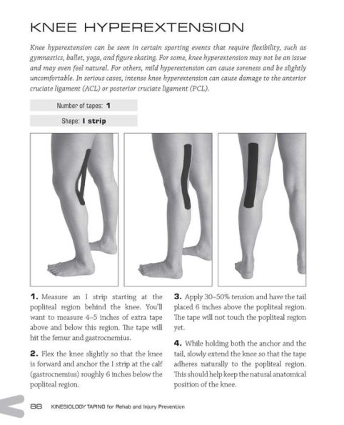 Kinesiology Taping for Rehab and Injury Prevention, Book by Aliana Kim, Official Publisher Page