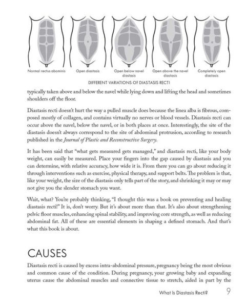 Mom's Guide to Diastasis Recti: A Program for Preventing and Healing Abdominal Separation Caused by Pregnancy