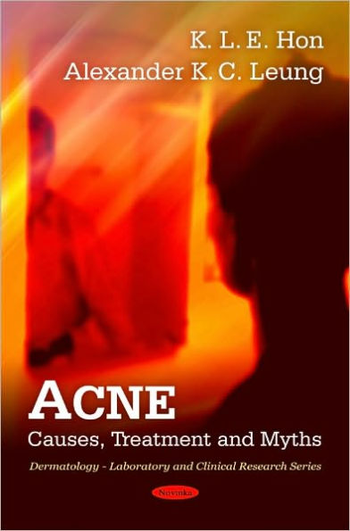 Acne: Causes, Treatment and Myths