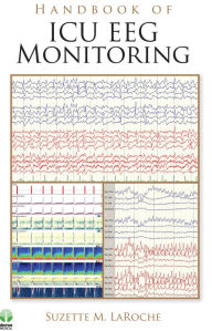 Title: Handbook of ICU EEG Monitoring, Author: Suzette LaRoche MD