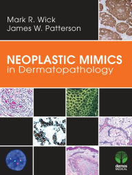 Title: Neoplastic Mimics in Dermatopathology, Author: Mark R. Wick MD