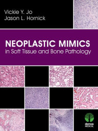Title: Neoplastic Mimics in Soft Tissue and Bone Pathology, Author: Vickie Y. Jo MD