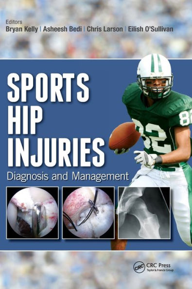 Sports Hip Injuries: Diagnosis and Management