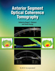 Title: Anterior Segment Optical Coherence Tomography, Author: Roger Steinert