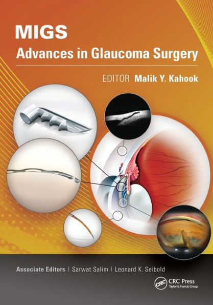 MIGS: Advances Glaucoma Surgery