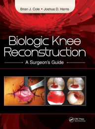 Title: Biologic Knee Reconstruction: A Surgeon's Guide / Edition 1, Author: Brian Cole