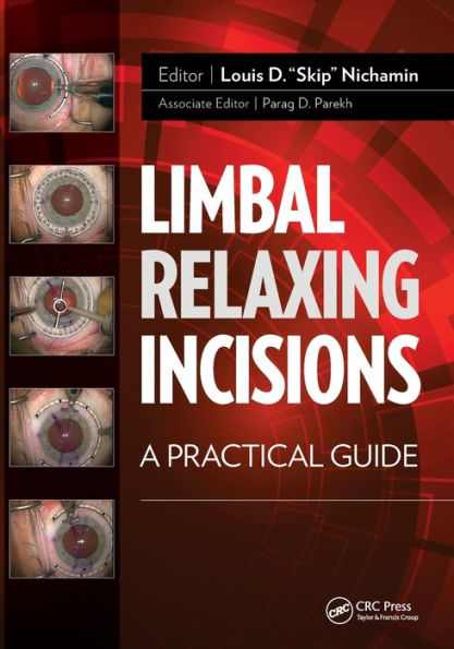 Limbal Relaxing Incisions: A Practical Guide / Edition 1