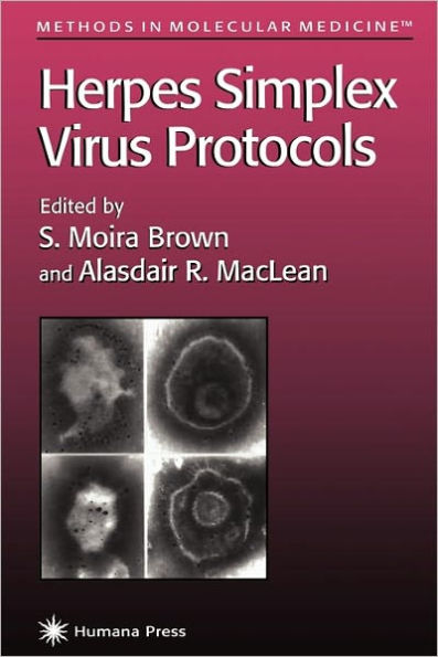 Herpes Simplex Virus Protocols / Edition 1
