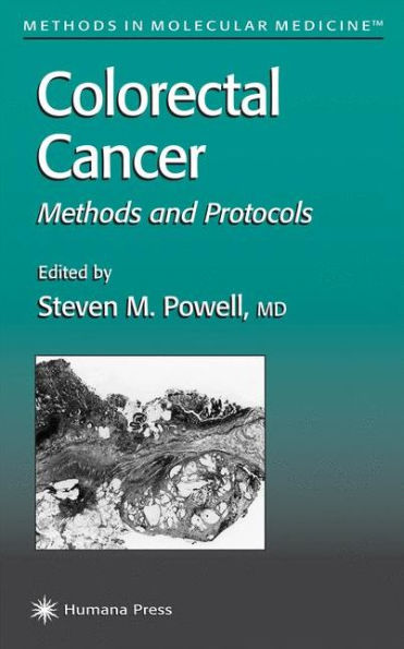 Colorectal Cancer: Methods and Protocols / Edition 1